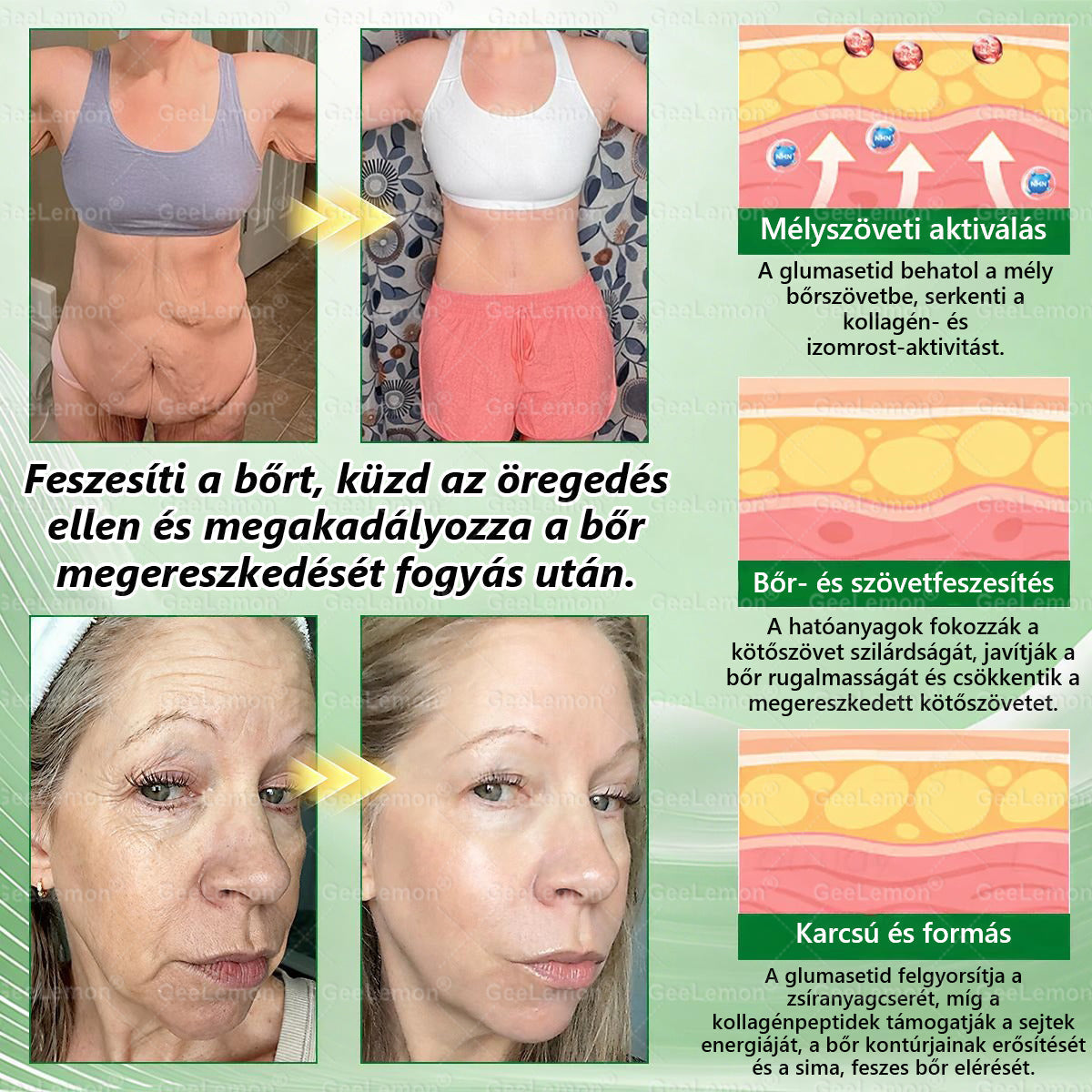 🎄 Hivatalos tanúsítás🔥 Több ezer elégedett felhasználó Magyarországon| 🤍𝐆𝐞𝑒𝐿𝑒𝐦𝐨𝐧® Glumasetide 10 az 1-ben Karcsú és Egészséges Nano Mikrotűs Tapasz 🇭🇺