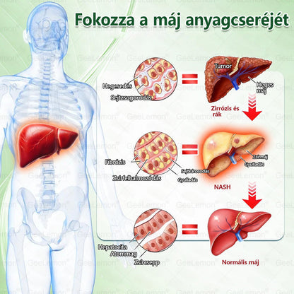 🎄 Hivatalos tanúsítás🔥 Több ezer elégedett felhasználó Magyarországon| 🤍𝐆𝐞𝑒𝐿𝑒𝐦𝐨𝐧® Glumasetide 10 az 1-ben Karcsú és Egészséges Nano Mikrotűs Tapasz 🇭🇺