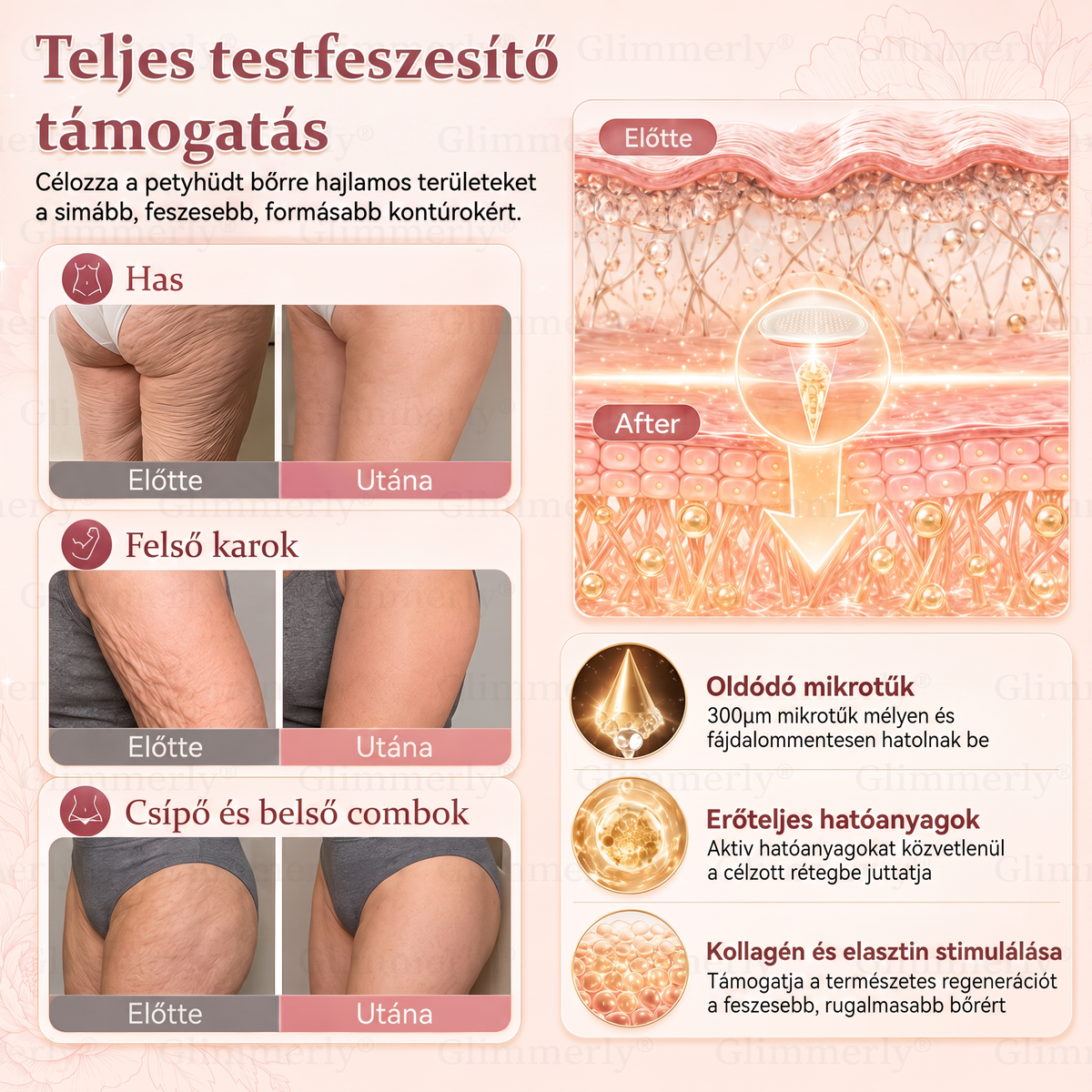 🎧𝐆𝐥𝐢𝐦𝐦𝐞𝐫𝐥𝐲® Mellvolumen-növelő és feszesítő mikrotűs tapaszok 🎧