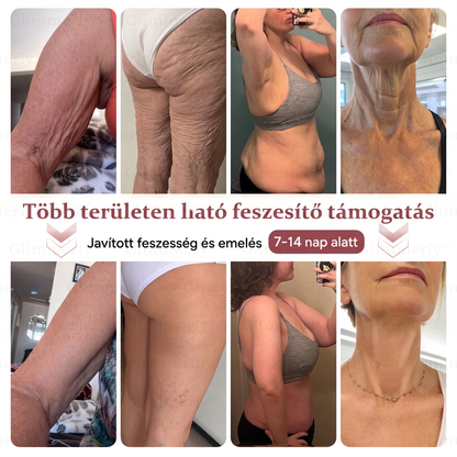 🎧𝐆𝐥𝐢𝐦𝐦𝐞𝐫𝐥𝐲® Mellvolumen-növelő és feszesítő mikrotűs tapaszok 🎧