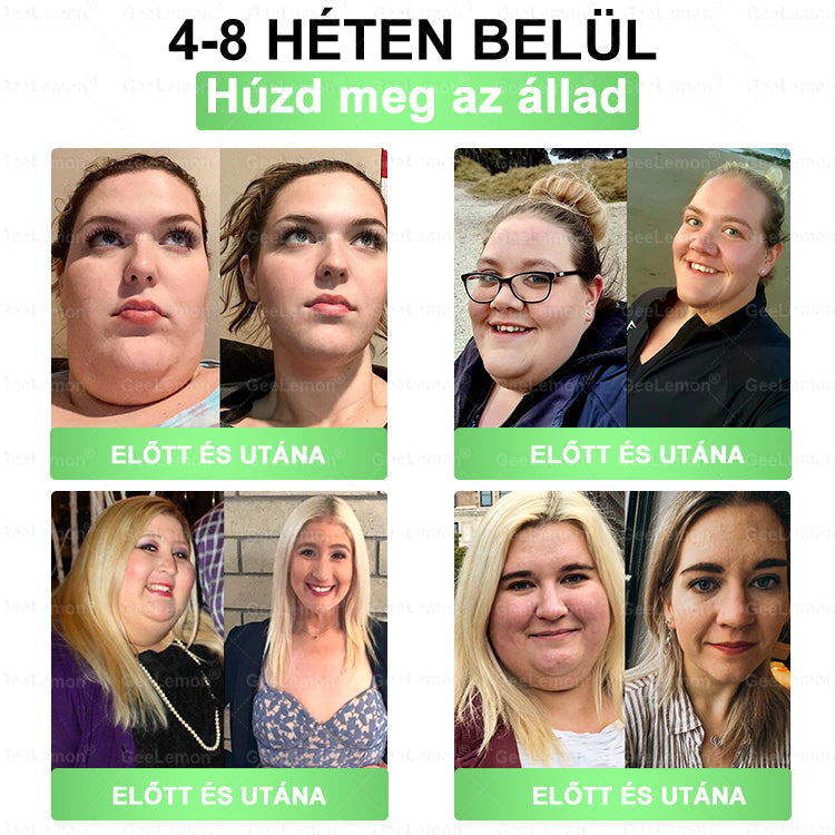 🎄 Hivatalos tanúsítás🔥 Több ezer elégedett felhasználó Magyarországon| 🤍𝐆𝐞𝑒𝐿𝑒𝐦𝐨𝐧® Glumasetide 10 az 1-ben Karcsú és Egészséges Nano Mikrotűs Tapasz 🇭🇺