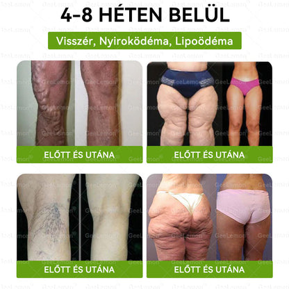 🎄 Hivatalos tanúsítás🔥 Több ezer elégedett felhasználó Magyarországon| 🤍𝐆𝐞𝑒𝐿𝑒𝐦𝐨𝐧® Glumasetide 10 az 1-ben Karcsú és Egészséges Nano Mikrotűs Tapasz 🇭🇺