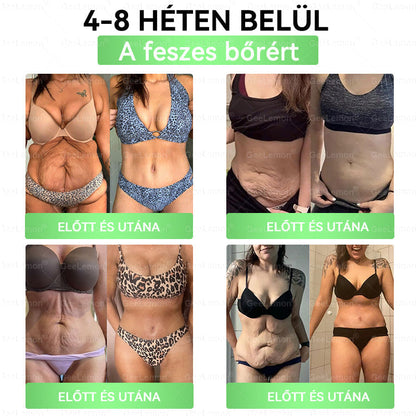 🎄 Hivatalos tanúsítás🔥 Több ezer elégedett felhasználó Magyarországon| 🤍𝐆𝐞𝑒𝐿𝑒𝐦𝐨𝐧® Glumasetide 10 az 1-ben Karcsú és Egészséges Nano Mikrotűs Tapasz 🇭🇺